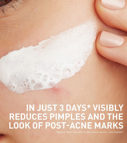Acne Clay To Foam Cleanser